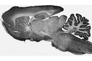 Adult rat brain immunohistochemistry. (ARL6 抗体  (AA 1-186))