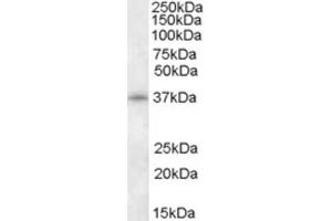 Western Blotting (WB) image for anti-Cyclin-Dependent Kinase 10 (CDK10) (N-Term) antibody (ABIN2466821) (CDK10 抗体  (N-Term))