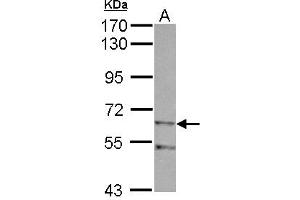 Western Blotting (WB) image for anti-Zinc Finger, Imprinted 2 (ZIM2) (AA 271-490) antibody (ABIN1501825) (ZIM2 抗体  (AA 271-490))