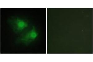 Immunofluorescence analysis of HeLa cells, using LIMK2 Antibody. (LIMK2 抗体  (AA 461-510))