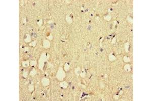 Immunohistochemistry of paraffin-embedded human brain tissue using ABIN7168509 at dilution of 1:100 (RYR2 抗体  (AA 901-1192))