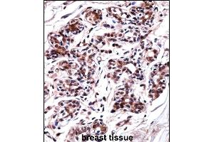 UBP1 Antibody (Center) ((ABIN657986 and ABIN2846933))immunohistochemistry analysis in formalin fixed and paraffin embedded human breast tissue followed by peroxidase conjugation of the secondary antibody and DAB staining. (UBP1 抗体  (AA 266-295))