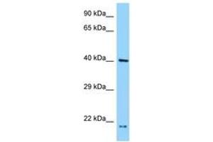 Image no. 1 for anti-PRP18 Pre-mRNA Processing Factor 18 (PRPF18) (N-Term) antibody (ABIN6748064) (PRPF18 抗体  (N-Term))