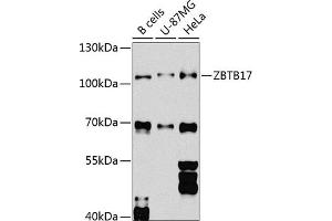 ZBTB17 抗体  (AA 121-360)