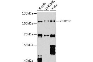 Western blot analysis of extracts of various cell lines, using ZBTB17 Antibody (ABIN6133380, ABIN6150370, ABIN6150371 and ABIN6224531) at 1:1000 dilution. (ZBTB17 抗体  (AA 121-360))