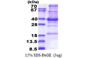SDS-PAGE (SDS) image for Centromere Protein P (CENPP) (AA 1-288) protein (His tag) (ABIN5853397) (CENPP Protein (AA 1-288) (His tag))