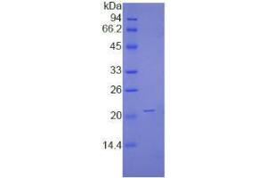 SDS-PAGE analysis of Human NME1 Protein. (NME1 蛋白)