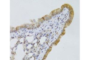 Immunohistochemistry of paraffin-embedded Mouse lung using GPD2 Polyclonal Antibody at dilution of 1:100 (40x lens). (GPD2 抗体)