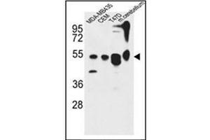 Western blot analysis of KIAA0652 Antibody (N-term) in MDA-MB435, CEM, 47D cell line and mouse cerebellum tissue lysates (35ug/lane).