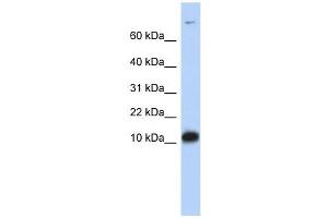 FABP3 antibody used at 1 ug/ml to detect target protein. (FABP3 抗体)