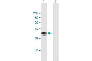 Western Blot analysis of GBA expression in transfected 293T cell line by GBA MaxPab polyclonal antibody.