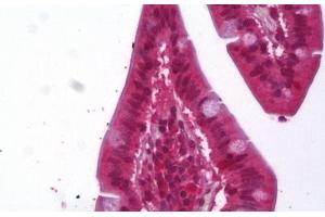 Anti-ACAT1 antibody IHC staining of human small intestine. (ACAT1 抗体)