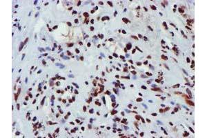 Image no. 11 for anti-Glutathione S-Transferase theta 2 (GSTT2) antibody (ABIN1498553) (GSTT2 抗体)