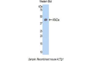 Western Blotting (WB) image for anti-Actin, gamma 1 (ACTG1) (AA 1-375) antibody (ABIN1077746) (Actin, gamma 1 抗体  (AA 1-375))