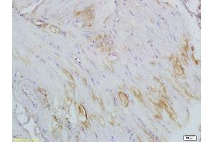 Immunohistochemistry (Paraffin-embedded Sections) (IHC (p)) image for anti-Collagen Triple Helix Repeat Containing 1 (CTHRC1) (AA 31-130) antibody (ABIN759281)