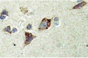 Immunohistochemistry (IHC) analyzes of Rsk-4 antibody in paraffin-embedded human brain tissue. (RPS6KA6 抗体)