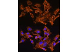Immunofluorescence analysis of C6 cells using A Rabbit pAb (ABIN6129944, ABIN6137377, ABIN6137378 and ABIN6224448) at dilution of 1:100. (AVPR1A 抗体  (AA 349-418))