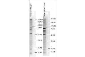 Western blot analysis is shown using  Affinity Purified anti-SH3BP2 pS427 antibody to detect endogenous protein present in unstimulated human whole cell lysates). (SH3BP2 抗体  (pSer427))