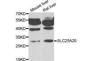 Western blot analysis of extracts of mouse liver and rat liver cell lines, using SLC25A20 antibody. (SLC25A20 抗体)