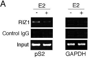 ChIP analysis of estrogen target genes.
