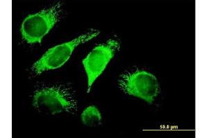 Immunofluorescence (IF) image for anti-DnaJ (Hsp40) Homolog, Subfamily A, Member 3 (DNAJA3) (AA 1-480) antibody (ABIN522528)
