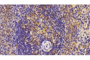Detection of IL6 in Rat Spleen Tissue using Polyclonal Antibody to Interleukin 6 (IL6) (IL-6 抗体  (AA 21-211))