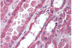 Human Kidney (formalin-fixed, paraffin-embedded) stained with IRAK4 antibody ABIN297197 at 10 ug/ml followed by biotinylated goat anti-rabbit IgG secondary antibody ABIN481713, alkaline phosphatase-streptavidin and chromogen. (IRAK4 抗体  (AA 38-54))