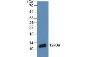Western blot analysis of recombinant Human S100A8. (S100A8 抗体  (AA 1-93))