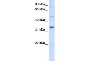 ZCCHC17 antibody used at 1 ug/ml to detect target protein. (ZCCHC17 抗体  (Middle Region))