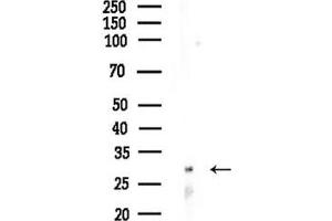 anti-Insulin Induced Gene 2 (INSIG2) (N-Term) antibody