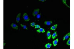 Immunofluorescent analysis of A549 cells using ABIN7173237 at dilution of 1:100 and Alexa Fluor 488-congugated AffiniPure Goat Anti-Rabbit IgG(H+L) (TMEM53 抗体  (AA 1-170))