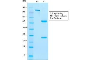 SDS-PAGE Analysis Purified NKX2. (Recombinant Nkx2-2 抗体)