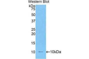 Western Blotting (WB) image for anti-Interleukin 6 Receptor (IL6R) (AA 19-10) antibody (ABIN1862786) (IL-6 Receptor 抗体  (AA 19-10))