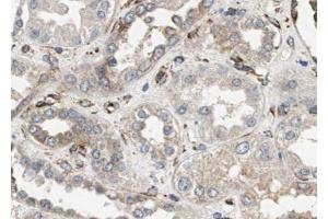 ABIN6272853 at 1/100 staining human kidney tissue sections by IHC-P. (GADD34 抗体)