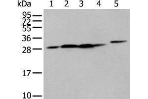 Western blot analysis of 293T cell Human fetal liver tissue A549 and Hepg2 cell using FKBP7 Polyclonal Antibody at dilution of 1:400 (FKBP7 抗体)