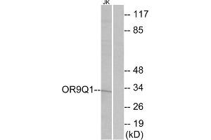 Western blot analysis of extracts from Jurkat cells, using OR9Q1 antibody. (OR9Q1 抗体  (C-Term))