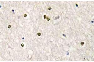 Immunohistochemistry (IHC) analyzes of CRSP77 antibody in paraffin-embedded human brain tissue. (MED17 抗体)
