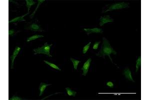 Immunofluorescence of monoclonal antibody to TLN1 on HeLa cell. (TLN1 抗体  (AA 1324-1424))