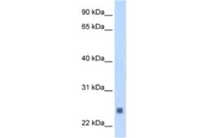 Western Blotting (WB) image for anti-Fast Skeletal Troponin I (TNNI2) antibody (ABIN2463421) (TNNI2 抗体)