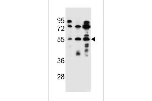 FUT6 Antibody (N-term) (ABIN656868 and ABIN2846072) western blot analysis in ZR-75-1,NCI-,293 cell line lysates (35 μg/lane).