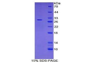 SDS-PAGE analysis of Human CLEC13A Protein. (DCL1 蛋白)