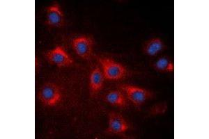 Immunofluorescent analysis of RPS20 staining in A549 cells. (RPS20 抗体)