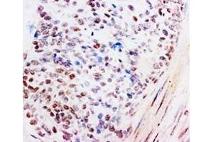 Immunohistochemistry (Paraffin-embedded Sections) (IHC (p)) image for anti-Nuclear Receptor Subfamily 3, Group C, Member 1 (Glucocorticoid Receptor) (NR3C1) (C-Term) antibody (ABIN1107374)