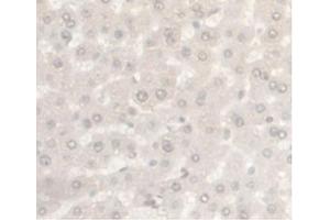 IHC-P analysis of Rat Liver Tissue, with DAB staining. (Androgen Receptor 抗体  (AA 491-679))