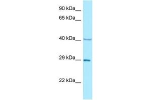 WB Suggested Anti-NCK1 Antibody Titration: 1. (NCK1 抗体  (N-Term))