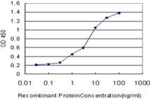 Detection limit for recombinant GST tagged ACADVL is approximately 0. (ACADVL 抗体  (AA 345-434))