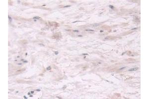 Immunohistochemistry (IHC) image for anti-Thiopurine S-Methyltransferase (TPMT) (AA 26-227) antibody (ABIN7435148)