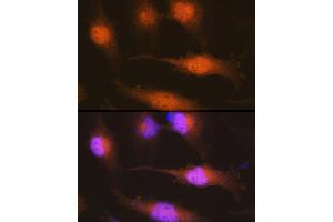 Immunofluorescence analysis of U-251 MG cells using Huntingtin Rabbit pAb (ABIN7267794) at dilution of 1:100 (40x lens). (Huntingtin 抗体)