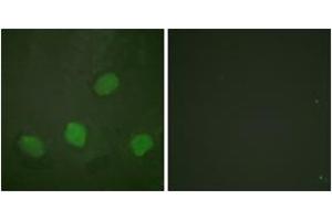 Immunofluorescence analysis of HeLa cells, using CREB (Phospho-Ser142) Antibody. (CREB1 抗体  (pSer142))