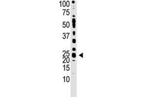 Image no. 1 for anti-Teratocarcinoma-Derived Growth Factor 1 (TDGF1) (N-Term) antibody (ABIN357430) (TDGF1 抗体  (N-Term))
